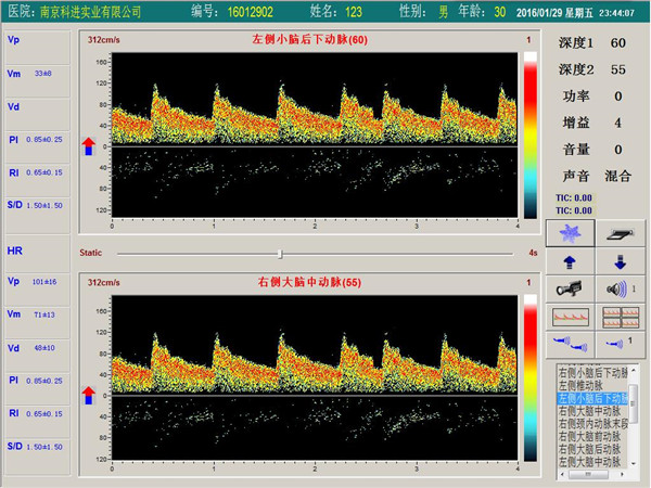 經(jīng)顱多普勒雙通道，單深度界面
