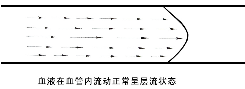 血液在血管內流動正常呈層流狀態(tài).jpg