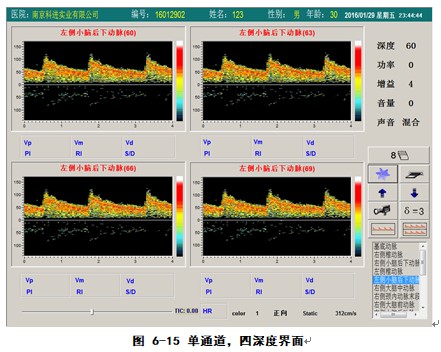 經(jīng)顱多普勒軟件單通道四深度檢測界面