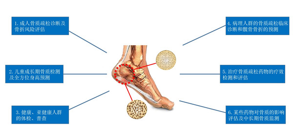 超聲骨密度儀跟骨測(cè)量位置