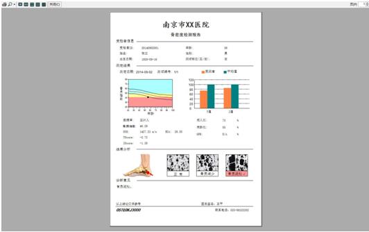 骨密度儀報(bào)告1